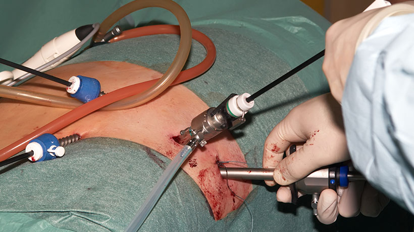 Can weight loss surgery be a cure for diabetes? - CCH