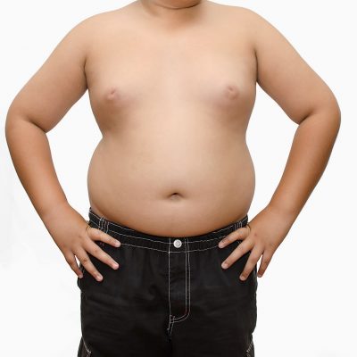 childhood obesity