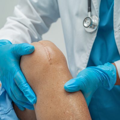 Doctor looking at a patient's knee.