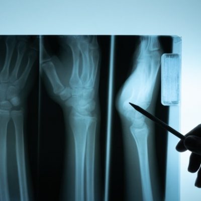 Doctor examining xray