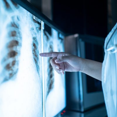 Doctors Looking At X-Ray Results