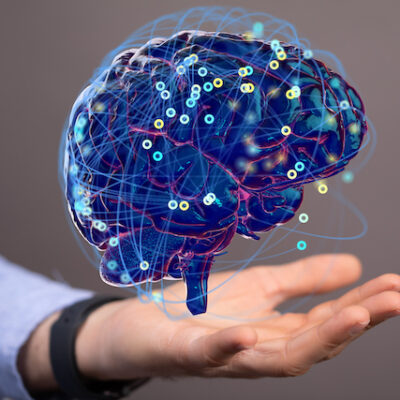 A wired human brain.