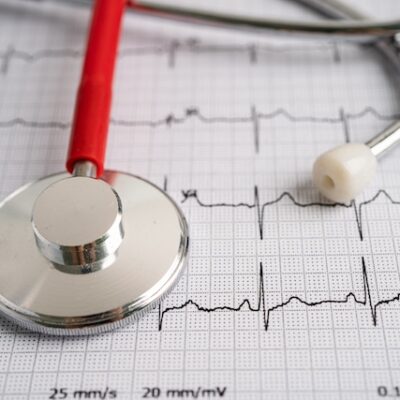 Stethoscope on electrocardiogram ECG, heart wave, heart attack, cardiogram report.