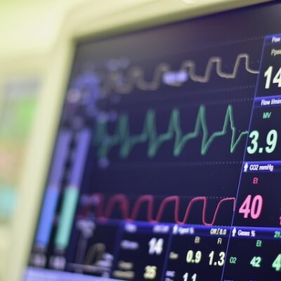 Heart monitor in a hospital.