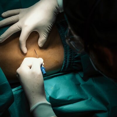 Surgeon injecting anesthesia with sterile syringe into the patient before surgery.
