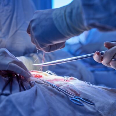 Surgical operation up close.