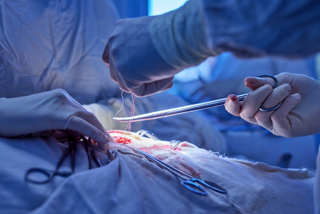 retatrutide at night Retatrutide Fatigue: 18 Fixes That Actually Worked for Patients retatrutide at night Retatrutide Fatigue: 18 Fixes That Actually Worked for Patients