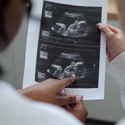 Observing ultrasound images during pregnancy checkup.