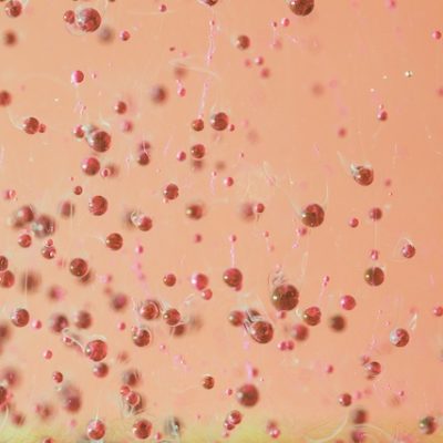 Abstract photo of protein under a microscope.