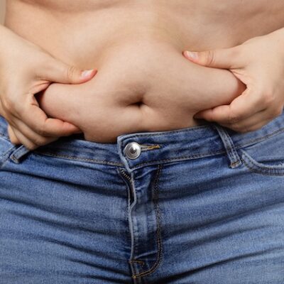 Visceral fat on a middle aged woman.