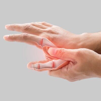 Man with arthritis in his hands.