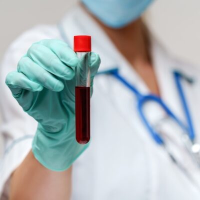 Nurse woman wearing protective mask and gloves - holding blood test tube.